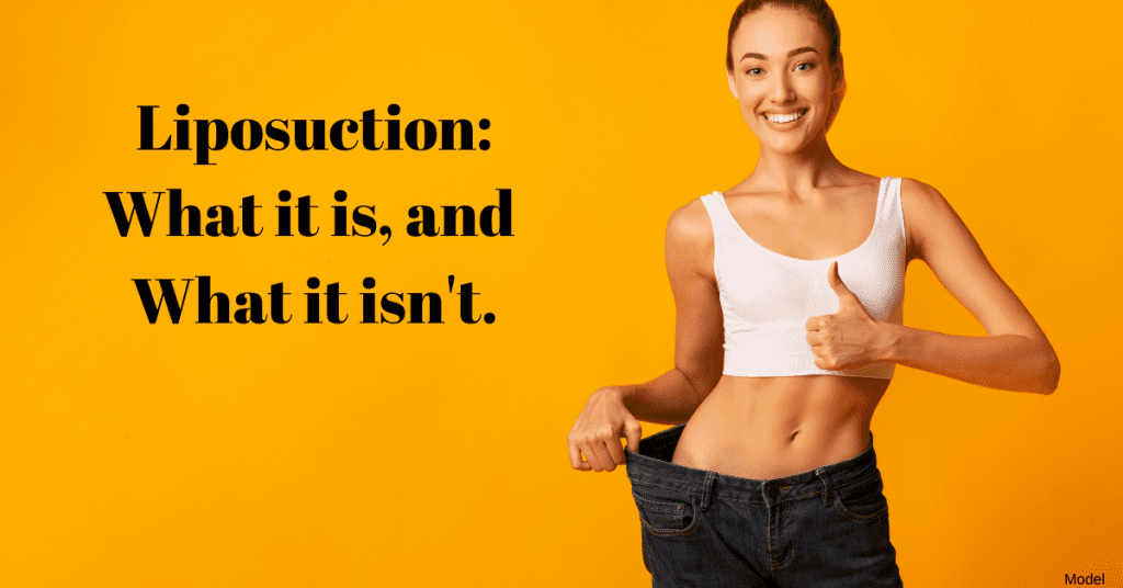 Liposuction: What It Is and What It Isn't