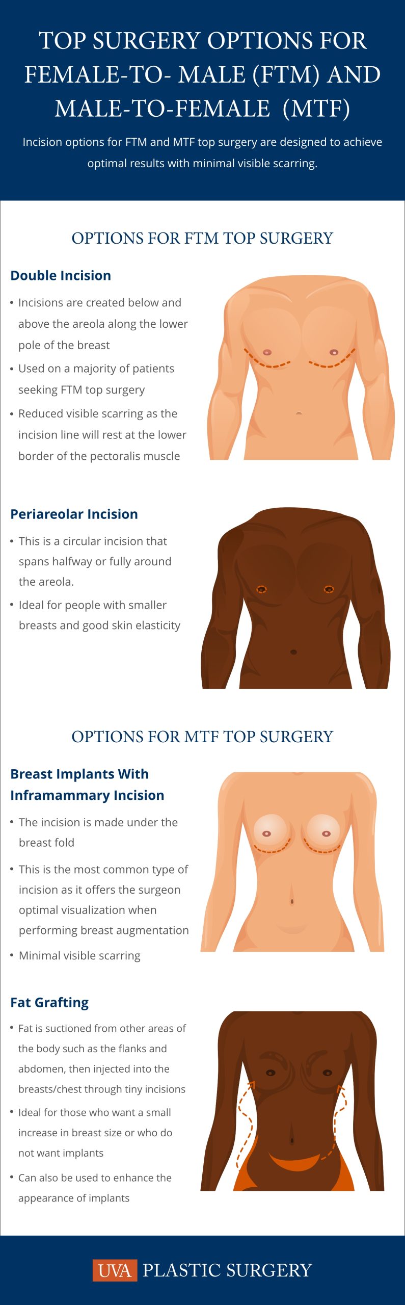Illustration of incision lines on FTM and MTF top surgery.